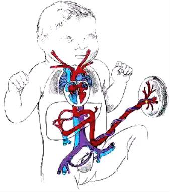 ! Shunting permits oxygenated blood from the umbilicus to bypass the developing pulmonary system and enter the systemic system.