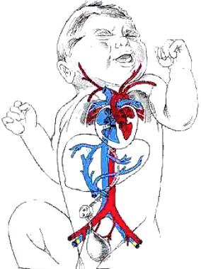 changes at birth! at birth, cutting the umbilical cord and changes in the lungs after the first breaths trigger major functional adaptations in the fetal circulatory system!