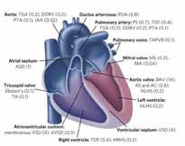 congenital heart disease (CHD) How do we identify the genes associated with these defects?! familial: gene mapping!