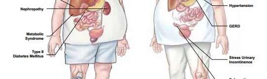typical malnutrition seen in patients with obesity, which