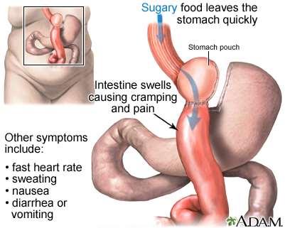 Prevalence of Preoperative Deficiencies The most common deficiencies in bariatric surgery candidates are in: 1.