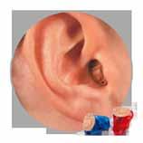 Most models include directional microphones for improved hearing in noise. Completely In The Canal (CIC) CIC and micro CIC hearing aids are the smallest style and are nearly invisible.