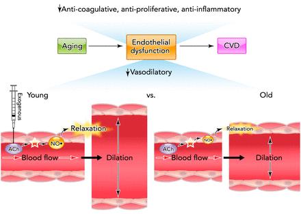 Endothelial dysfunction and CVD Endothelial dysfunction can be defined as any phenotype in which this normal functional state is