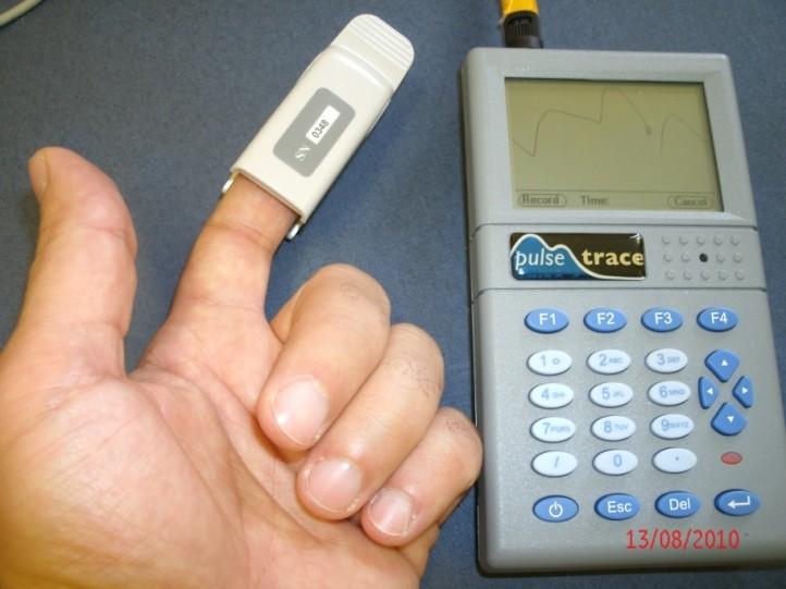 The Finometer Measures: Blood pressure, heart
