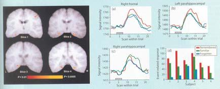 left hemisphere, the putamen in the basal ganglia bilaterally, the rostral prefrontal
