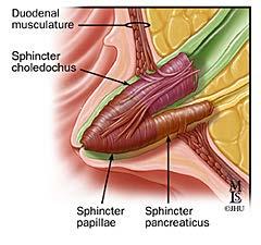 SPHINCTER OF ODDI DYSFUNCTION (SOD) Sphincter of Oddi dysfunction refers to structural or functional disorders involving the biliary sphincter that may result in impedance of bile and pancreatic