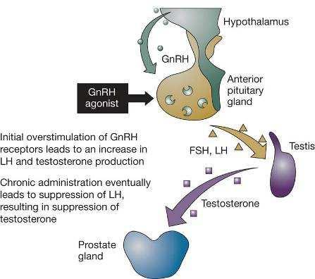 Mechanism of action of GnRH agonists GnRH agonists Acute pituitary effects Surge in FSH, LH and testosterone Chronic pituitary effects LH and testosterone suppression, but