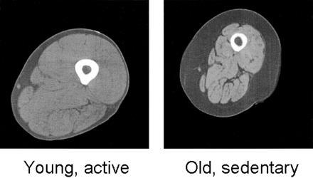 Changes in muscle size and strength with aging: Reduced muscle quality fat Muscle Quad muscle area