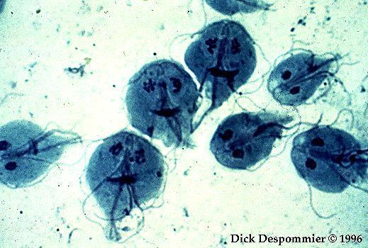 Characterized by diarrhea agent: Giardia lamblia (a protozoan) epidemiology: drinking unfiltered water Hepatitis.