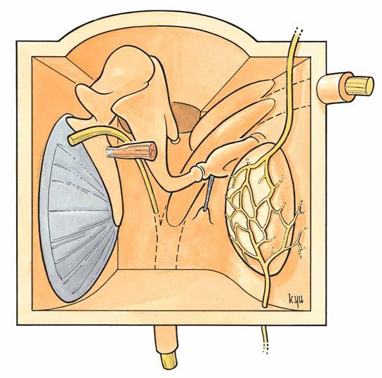 Diagram of Middle Ear Cavity Anterior wall removed ROOF Chorda tympani Tympanic membrane