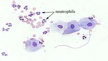 Neutrophils and