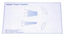 LAB PRODUCTS Bondable Cuspid to Cuspid Lingual Reatiners These lingual retainers are preformed with.028 stainless steel wire and 60 gauge foil mesh pads.