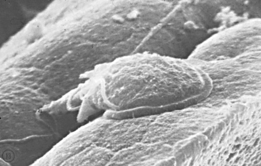 Parasite SEM of Giardia