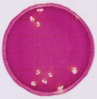 colonies and a high number of non-enterobacteriaceae, Gram-negative colonies.
