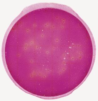 Figure 9 Figure 10 Enterobacteriaceae count = 44 Artifact bubbles may result from improper inoculation of the 3M Petrifilm. They are irregularly shaped and not associated with a red colony.