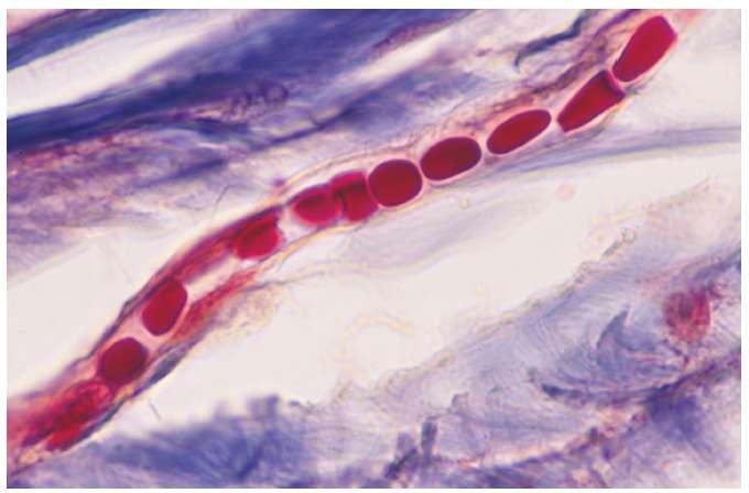 Capillaries After blood passes through muscles into the smallest blood vessels,.