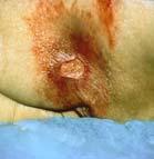 Condition of periwound skin Infection Pain Wound Etiology Location Correct identification
