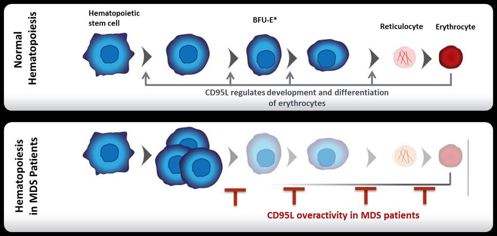 Myelodysplastic Syndromes (MDS) Myelodysplastic syndromes (MDS) are clonal hematologic malignancies that are characterized by ineffective hematopoiesis, resulting in anemia CD95 has a key role in