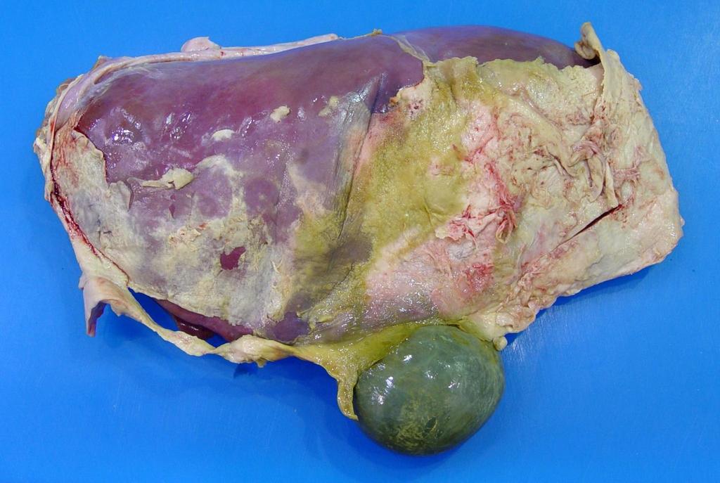Inflammation Case 1 Liver from a calf