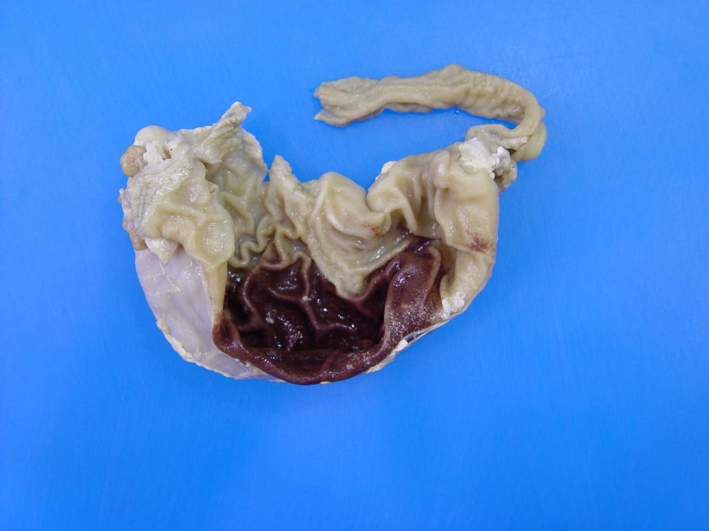 Stomach from an adult