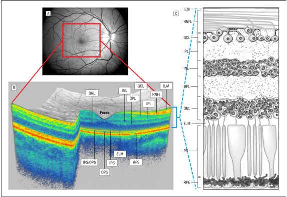 segments OPS: outer photoreceptor segments PR: photoreceptors RPE: retinal pigment epithelium -Healthy subject.