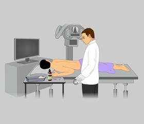 How is it Performed? Myelography is done on an outpatient basis. The patient is asked to lie face down on the examination table.