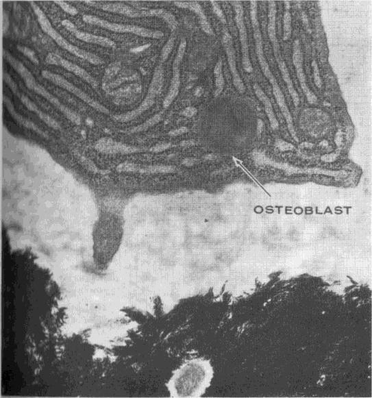 Osteoblasts and Osteoytes Unlike osteolasts, osteoblasts are mononulear ells that aid in forming new bone tissue (Figure 6).