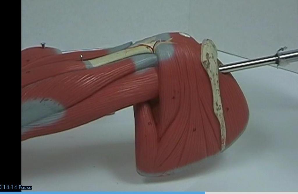 Muscles of the Arm Teres minor