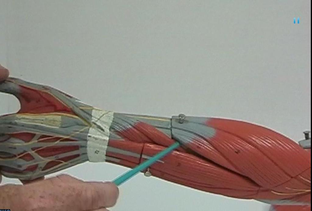 Muscles of the Forearm Extensor pollicis brevis