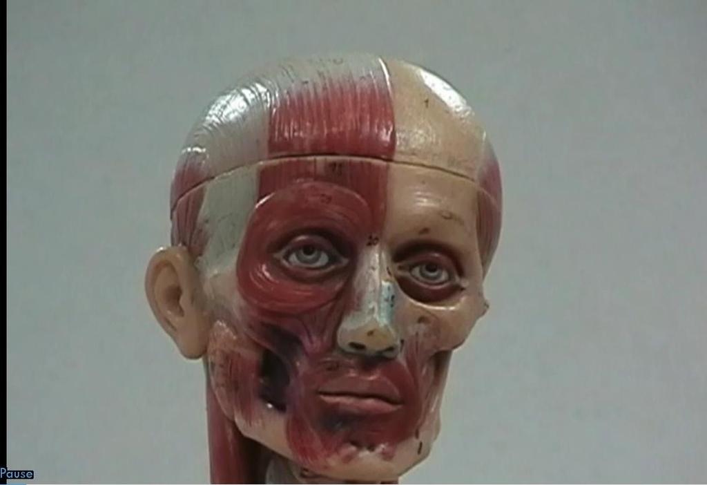 Muscles of Facial Expression Frontalis