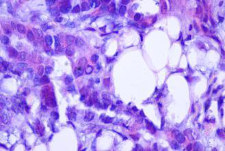 two-layered bland looking epithelium (H&E, 10X).