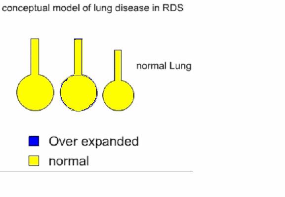 On the other hand if the alveoli is overdistended due to inappropriate pressures on the ventilator (CPAP), the pulmonary arterioles got stretched to a point where narrowing of their lumen causing
