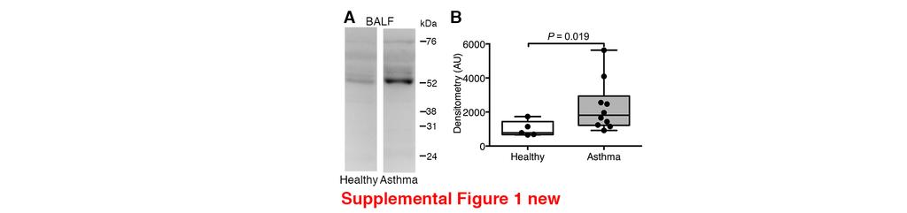 Revised Suppl. Data: Soluble ADAM33 3 Supplemental Figure 1: Increased soluble ADAM33 (sadam33) Pro- Metalloprotease in bronchoalveolar lavage fluid (BALF) in human asthma.