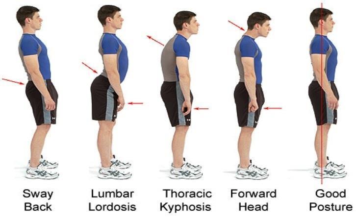 Stand up Straight Neutral Standing Posture: