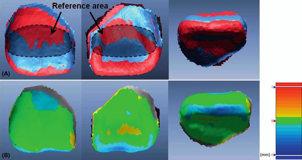 centrl incisors were extrcted from the 3D digitl models (Figure 1).