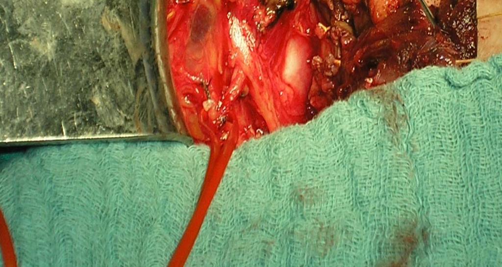 and were exposed upwards until their insertion in the larynx.