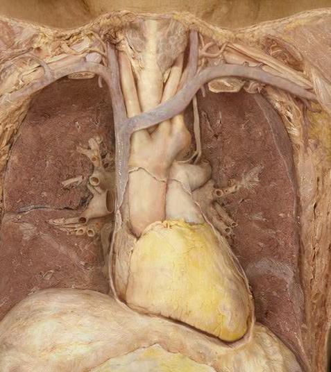 Cardiovascular system, thorax, arteries-anterior, dissection layer 4 Structures AP Revealed 2. heart 3. aorta a. aortic arch b. brachiocephalic artery c. left common carotid artery d.