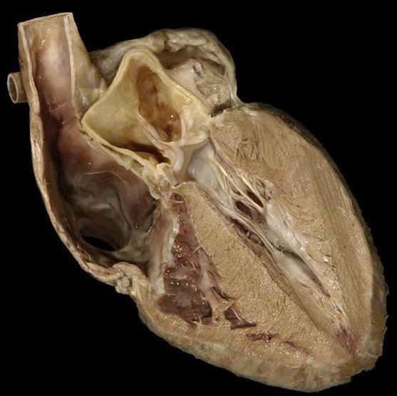 5 Cardiovascular system, heart, internal features-anterior, dissection layer 5 Structures AP Revealed 12. atrium (atria, pl.) a. right b. left 13. interventricular septum 14. atrioventricular valve a.