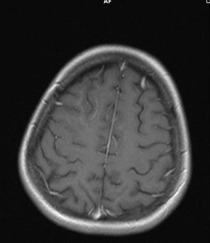 MRI - 04.