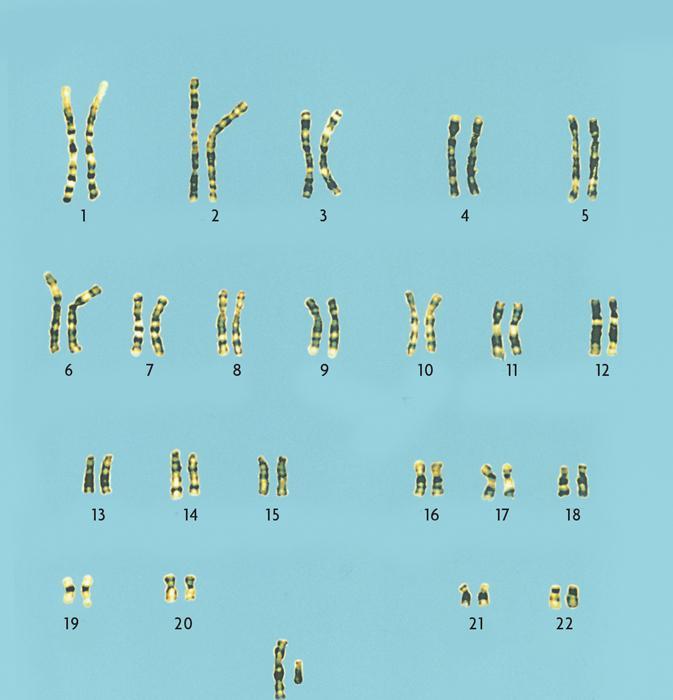 Karyotype Chemicals are used to stain the chromosomes Chemical stains produce a pattern of bands on the chromosomes Band size and