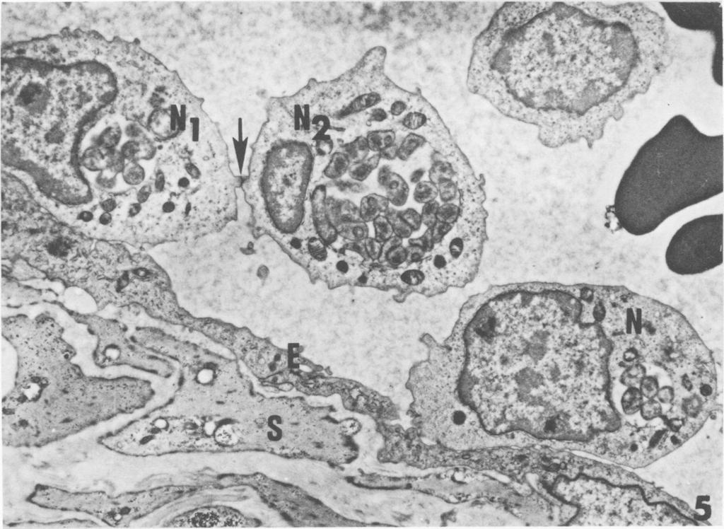 without inclusions (N1) to the endothelium (E). x35,000. Insert: High magnification of the intercellular space (arrow) shown in blocked off area. x70,000...'.a _ FIG. 5.