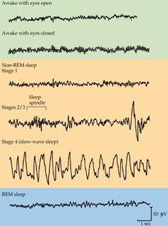 Human EEG