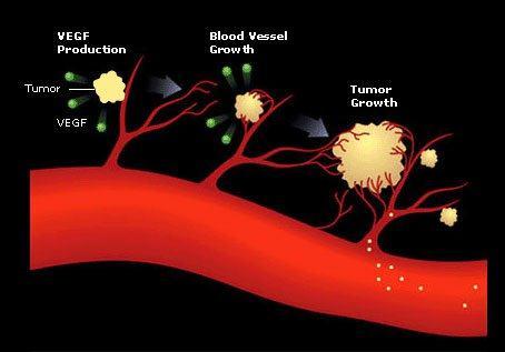 Cancers secrete vascular endothelial growth factor (VEGF) to stimulate the development of new blood vessels