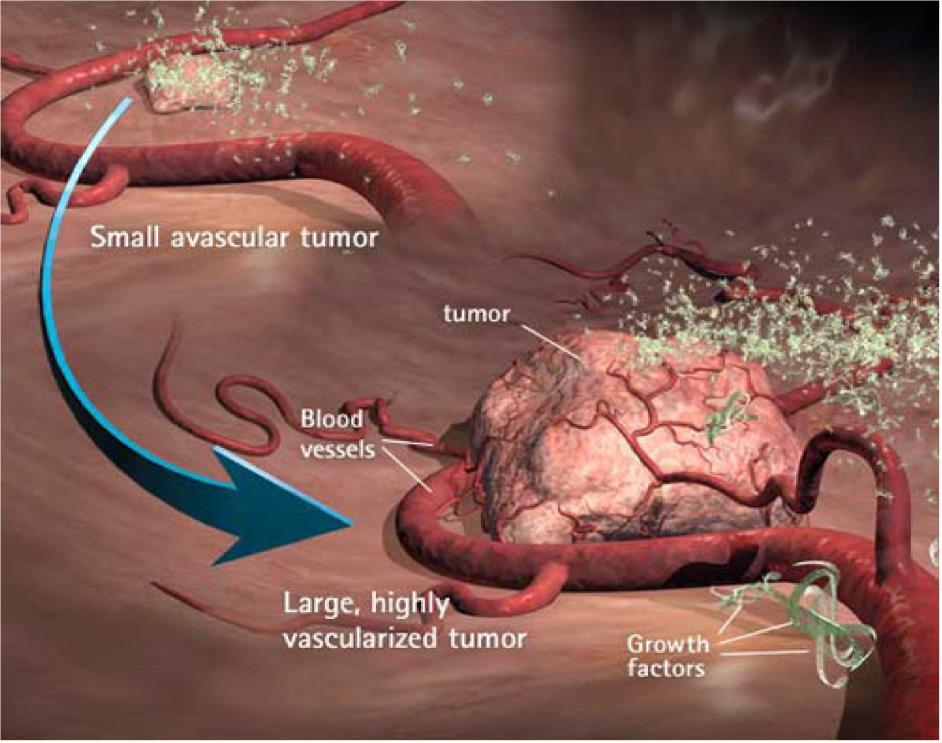 Tumour Angiogenesis Once a tumour exceeds >1mm it cannot receive adequate nutrients or oxygen from surrounding tissues.