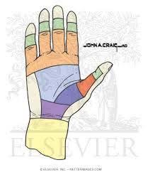 Zone V: Proximal to the Carpal tunnel Thumb Zones T I Distal to the IP joint TII From