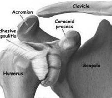 Understanding Shoulder Dysfunction REMINDER Obtain medical clearance and physician s
