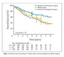 Retroperitoneal Sarcoma Radical Resection Strategy Compartmental