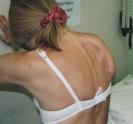 Scapulohumeral Rhythm Ratio of Scapular to Humeral movement Occurs via coupled movement of the