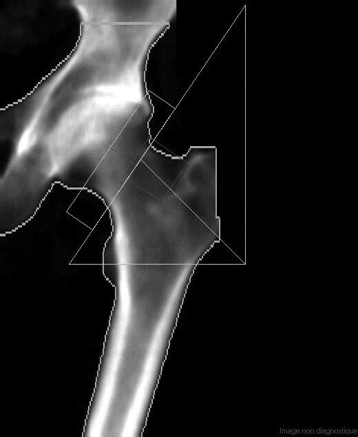 Examples among some common hip scanning