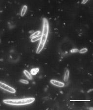 A B Fig. 4. Fusarium oxysporum produces macroconidia and microconidia. (A) Macroconidia are boat shaped (fusiform), tapered, and septate. Scale bar = 25 µm.